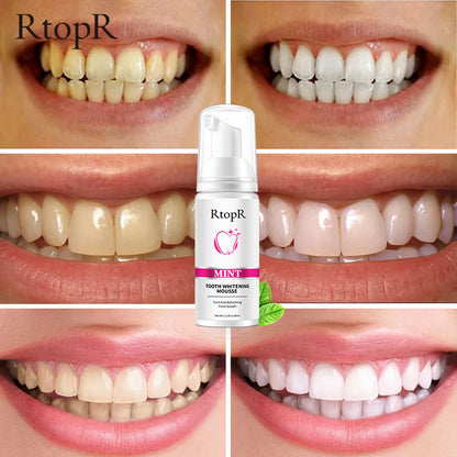 RtopR Teeth Cleansing Whitening Mousse Removes Stains